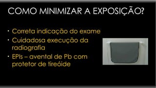 COMO MINIMIZAR A EXPOSIÇÃO ? Correta indicação do exame Cuidadosa execução da radiografia EPIs – avental de Pb com protetor de tireóide  
