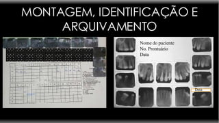 MONTAGEM, IDENTIFICAÇÃO E ARQUIVAMENTO Nome do paciente No. Prontuário Data Data 