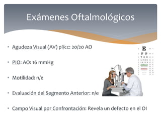• Agudeza Visual (AV) pl/cc: 20/20 AO
• PIO: AO: 16 mmHg
• Motilidad: n/e
• Evaluación del Segmento Anterior: n/e
• Campo Visual por Confrontación: Revela un defecto en el OI
Exámenes Oftalmológicos
 