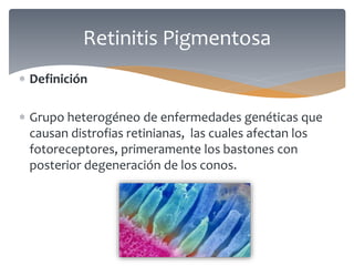  Definición
 Grupo heterogéneo de enfermedades genéticas que
causan distrofias retinianas, las cuales afectan los
fotoreceptores, primeramente los bastones con
posterior degeneración de los conos.
Retinitis Pigmentosa
 