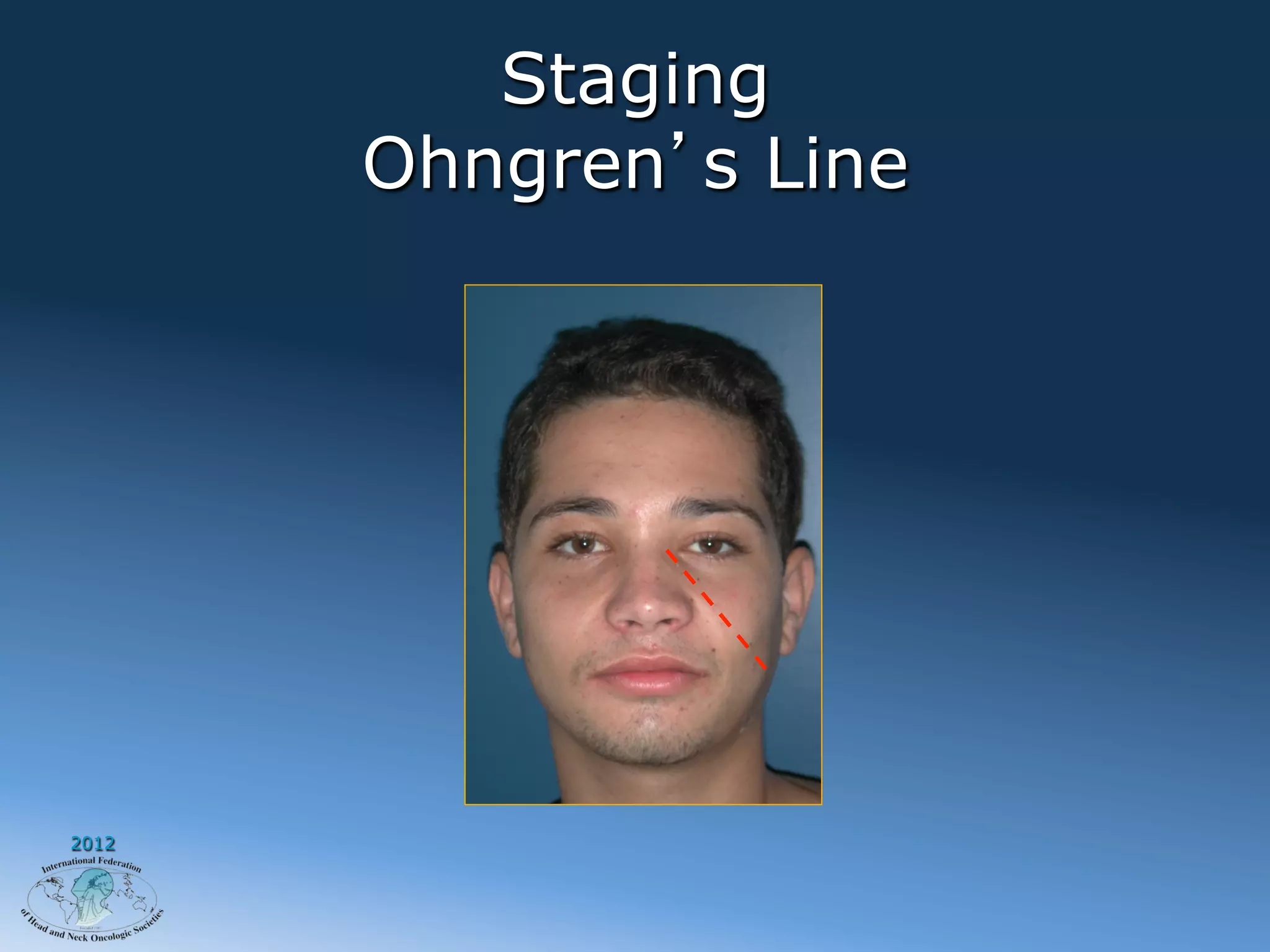 Staging
       Ohngren s Line




2012
 