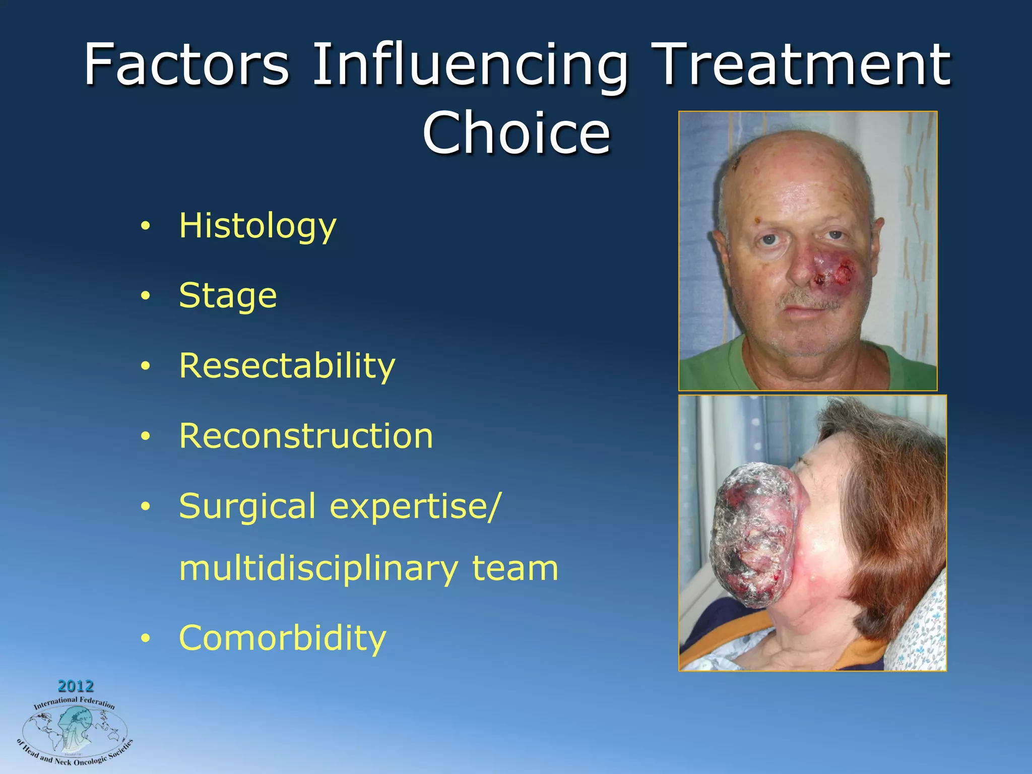 Factors Influencing Treatment
              Choice
       •  Histology

       •  Stage

       •  Resectability

       •  Reconstruction

       •  Surgical expertise/
         multidisciplinary team

       •  Comorbidity
2012
 
