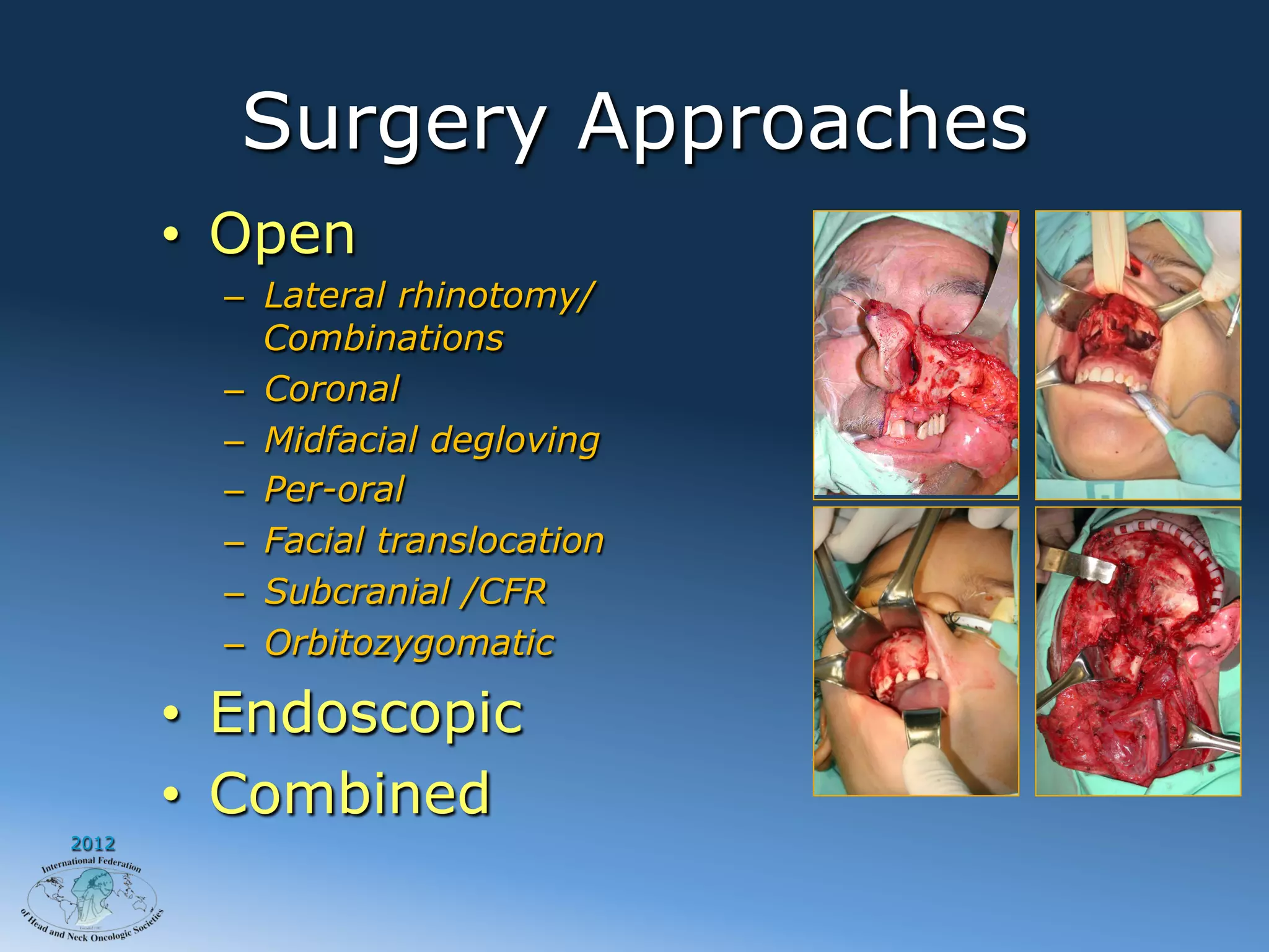 Surgery Approaches
       •  Open
         –  Lateral rhinotomy/
            Combinations
         –  Coronal
         –  Midfacial degloving
         –  Per-oral
         –  Facial translocation
         –  Subcranial /CFR
         –  Orbitozygomatic

       •  Endoscopic
       •  Combined
2012
 