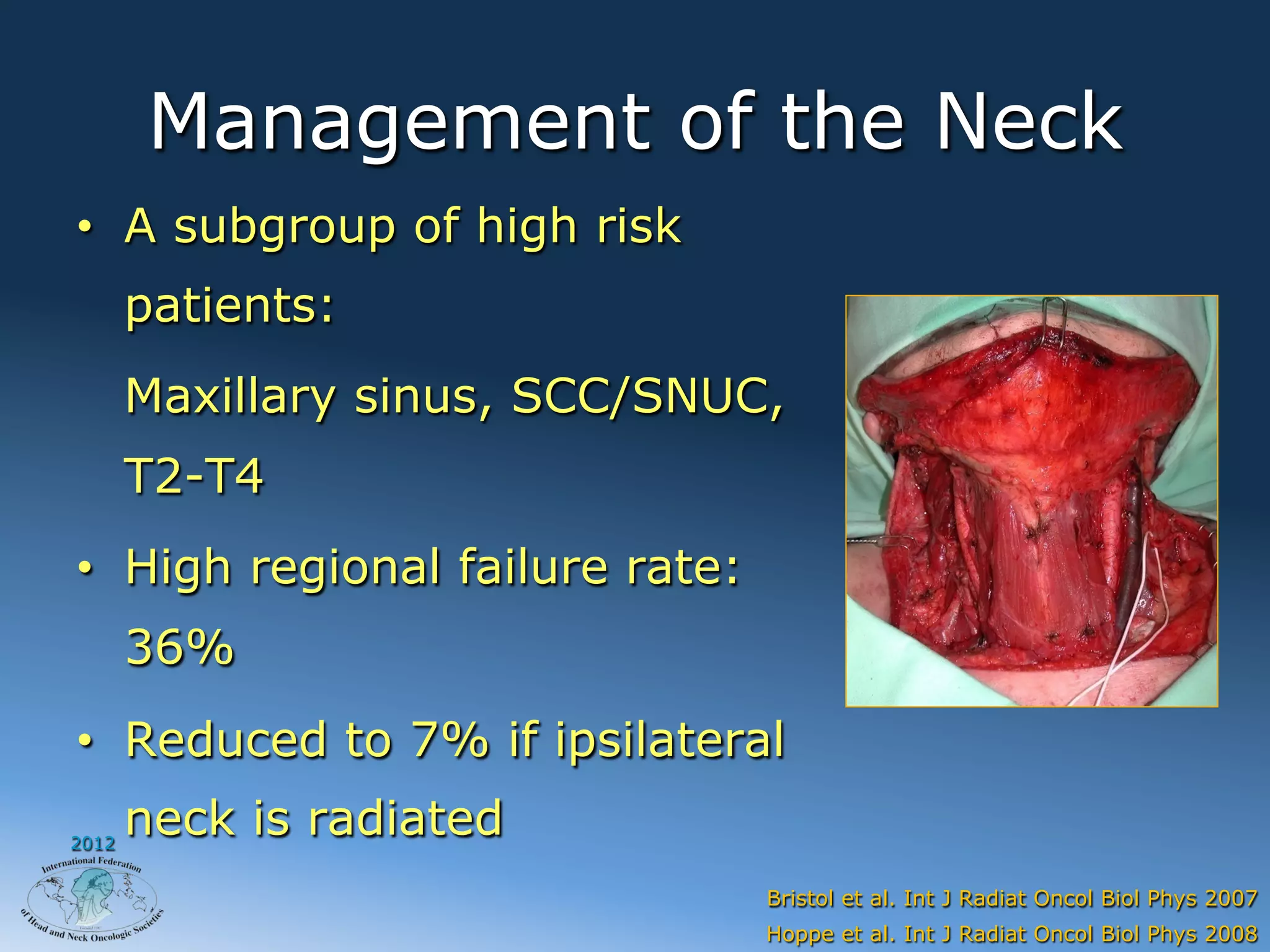 Management of the Neck
•  A subgroup of high risk
       patients:
       Maxillary sinus, SCC/SNUC,
       T2-T4
•  High regional failure rate:
       36%
•  Reduced to 7% if ipsilateral
2012
       neck is radiated
                                 Bristol et al. Int J Radiat Oncol Biol Phys 2007
                                 Hoppe et al. Int J Radiat Oncol Biol Phys 2008
 