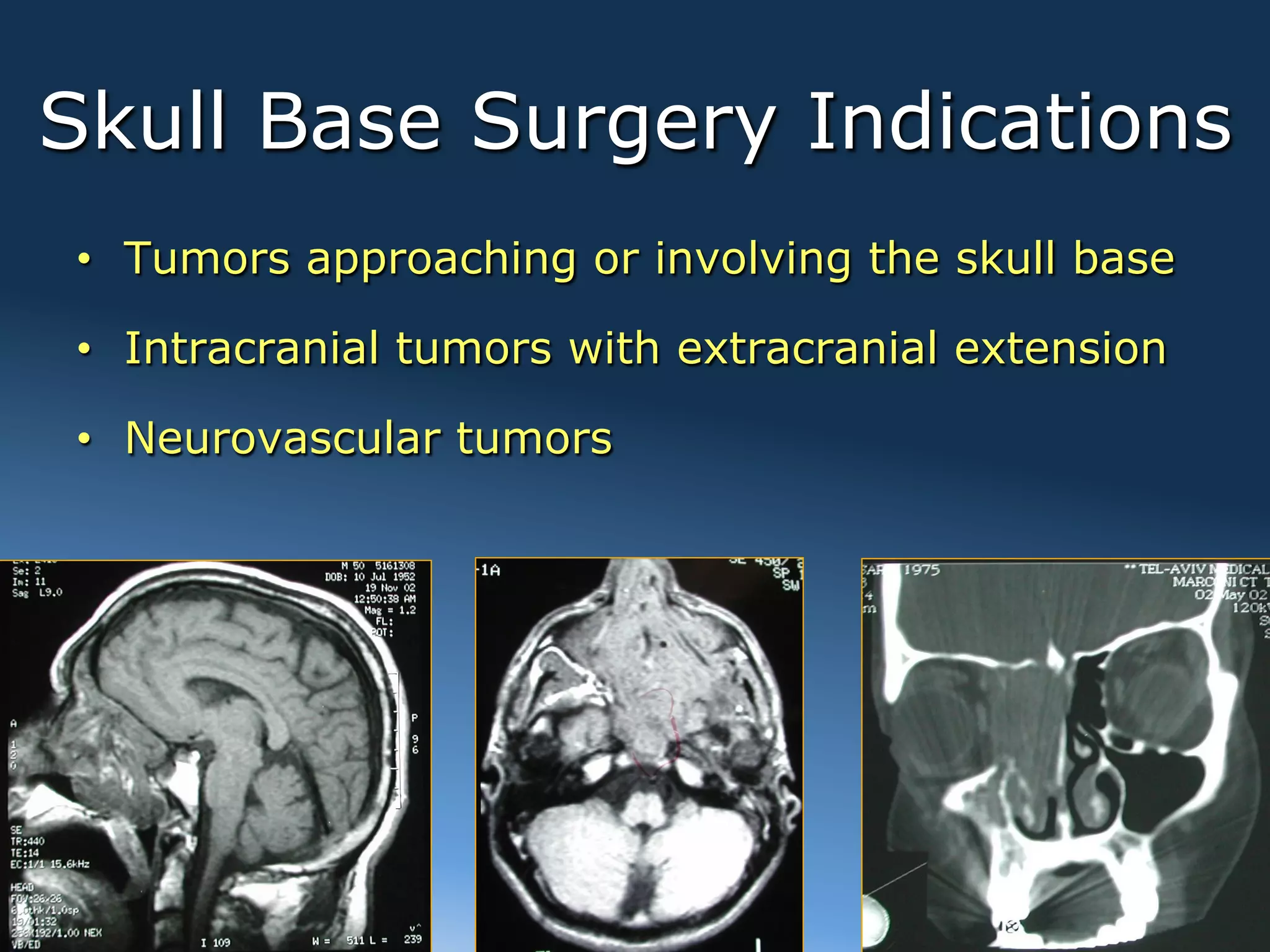 Skull Base Surgery Indications
•  Tumors approaching or involving the skull base

•  Intracranial tumors with extracranial extension

•  Neurovascular tumors




2012
 