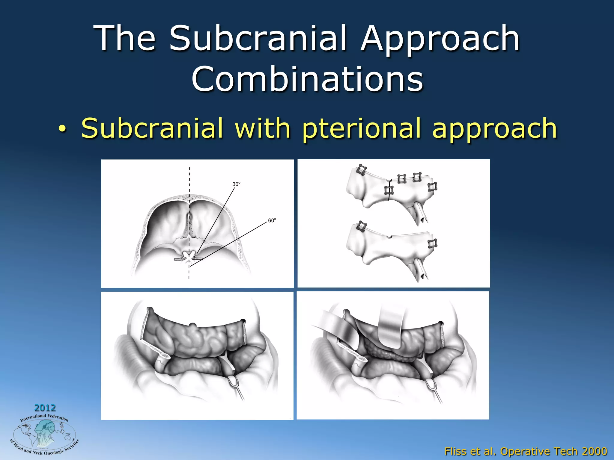 The Subcranial Approach
              Combinations
       •  Subcranial with pterional approach




2012




                                   Fliss et al. Operative Tech 2000
 