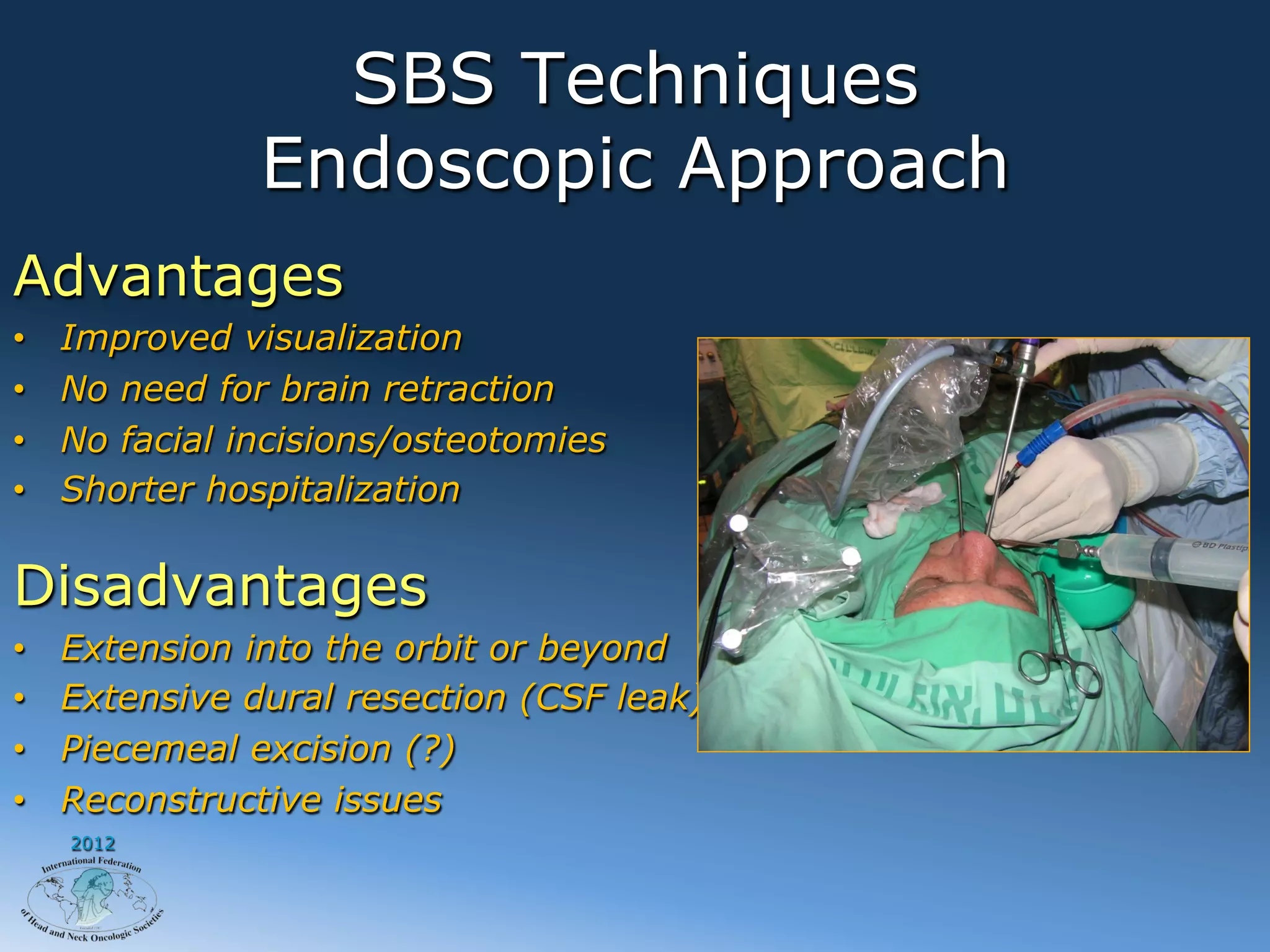 SBS Techniques
                Endoscopic Approach
Advantages
•    Improved visualization
•    No need for brain retraction
•    No facial incisions/osteotomies
•    Shorter hospitalization

Disadvantages
•    Extension into the orbit or beyond
•    Extensive dural resection (CSF leak)
•    Piecemeal excision (?)
•    Reconstructive issues
     2012
 