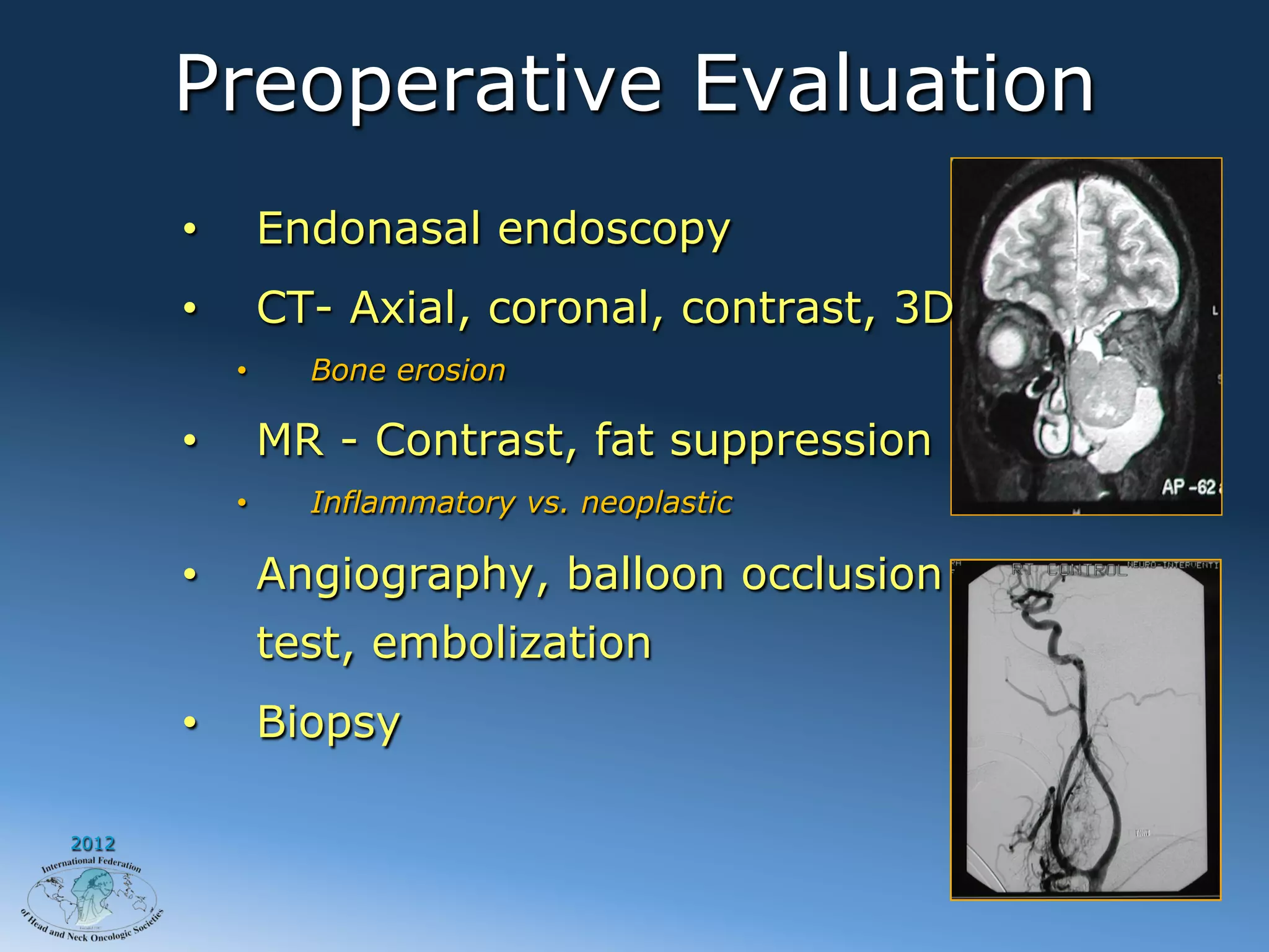Preoperative Evaluation
       •         Endonasal endoscopy
       •         CT- Axial, coronal, contrast, 3D
            •      Bone erosion

       •         MR - Contrast, fat suppression
            •      Inflammatory vs. neoplastic

       •         Angiography, balloon occlusion
                 test, embolization
       •         Biopsy

2012
 