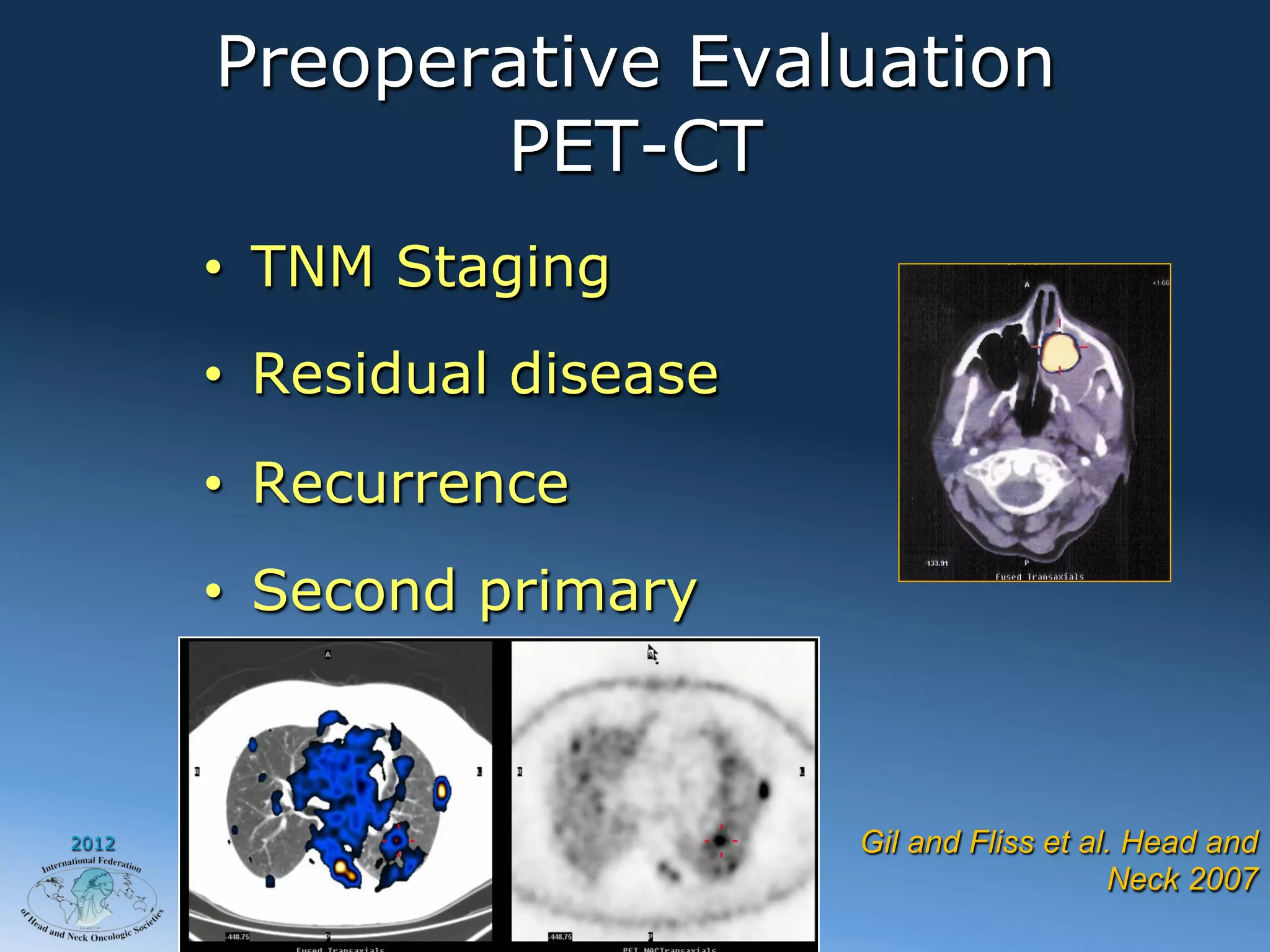Preoperative Evaluation
              PET-CT
       •  TNM Staging
       •  Residual disease
       •  Recurrence
       •  Second primary



2012                         Gil and Fliss et al. Head and
                                                Neck 2007
 