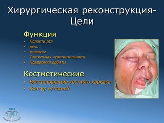 Хирургическая реконструкция-
           Цели
       Функция
       •    Полости рта
       •    речь
       •    жевание
       •    Тактильная чувствительность
       •    Поддержка орбиты


       Костметические
       •  Восстановление костного каркаса
       •  Контур м/тканей



2012
 