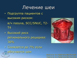 Лечение шеи
•  Подгруппа пациентов с
       высоким риском:
       в/ч пазуха, SCC/SNUC, T2-
       T4
•  Высокий риск
       регионального рецидива:
       36%
•  Снижается до 7% если
2012
       облучается шея
                                 Bristol et al. Int J Radiat Oncol Biol Phys 2007
                                 Hoppe et al. Int J Radiat Oncol Biol Phys 2008
 