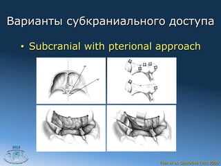 Варианты субкраниального доступа

       •  Subcranial with pterional approach




2012




                                   Fliss et al. Operative Tech 2000
 