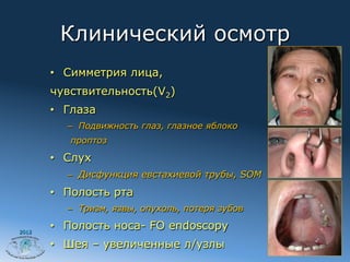 Клинический осмотр
       •  Симметрия лица,
       чувствительность(V2)
       •  Глаза
          –  Подвижность глаз, глазное яблоко
          проптоз

       •  Слух
          –  Дисфункция евстахиевой трубы, SOM
       •  Полость рта
          –  Тризм, язвы, опухоль, потеря зубов

2012
       •  Полость носа- FO endoscopy
       •  Шея – увеличенные л/узлы
 