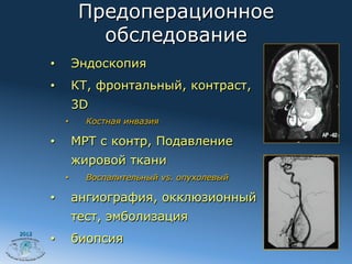 Предоперационное
                    обследование
       •         Эндоскопия
       •         КТ, фронтальный, контраст,
                 3D
            •      Костная инвазия

       •         МРТ с контр, Подавление
                 жировой ткани
            •      Воспалительный vs. опухолевый

       •         ангиография, окклюзионный
                 тест, эмболизация
                 биопсия
2012
       • 
 