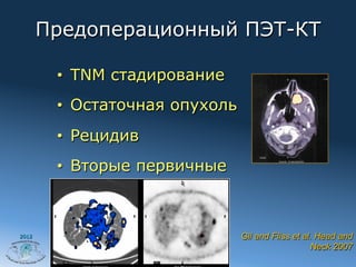 Предоперационный ПЭТ-КТ

        •  TNM стадирование
        •  Остаточная опухоль
        •  Рецидив
        •  Вторые первичные



2012                            Gil and Fliss et al. Head and
                                                   Neck 2007
 