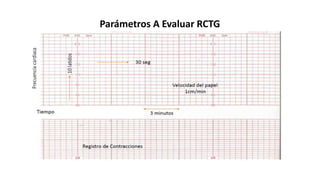 Parámetros A Evaluar RCTG
 
