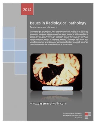 2014

Issues in Radiological pathology
Cerebrovascular disorders
Neuroimaging and neuropathology share common perspectives in medicine. In no field is this
more evident than in the diagnosis and study of nervous system pathology: radiology and
pathology are anatomically oriented specialties that depend primarily on structural changes to
diagnose disease. Both specialties are broadening their perspectives of morphology to
demonstrate metabolism, as with functional imaging in radiology and with
immunocytochemical markers in anatomical pathology. Pathologists thus regard their
radiologic counterparts as colleagues with similar morphologic approaches to diagnosis, despite
the different tools used. In no discipline is this companionship more strongly felt than in the
respective subspecialties that focus on disorders of the nervous system.

Professor Yasser Metwally
www.yassermetwally.com
1/1/2014

 