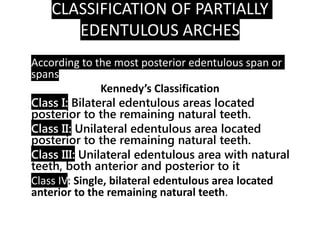 Edentulous Class Rpd Removable Partial Denture 1. Introduction | PDF
