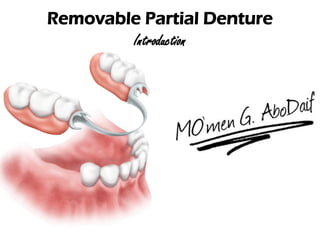 Removable Partial Denture
Introduction
 