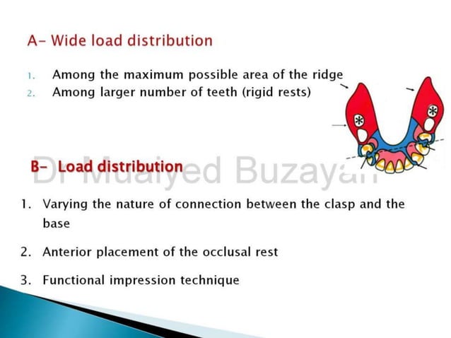 Lever Arm Rpd Rpd biomechanics principles of levers design consideration 4th year | PPT