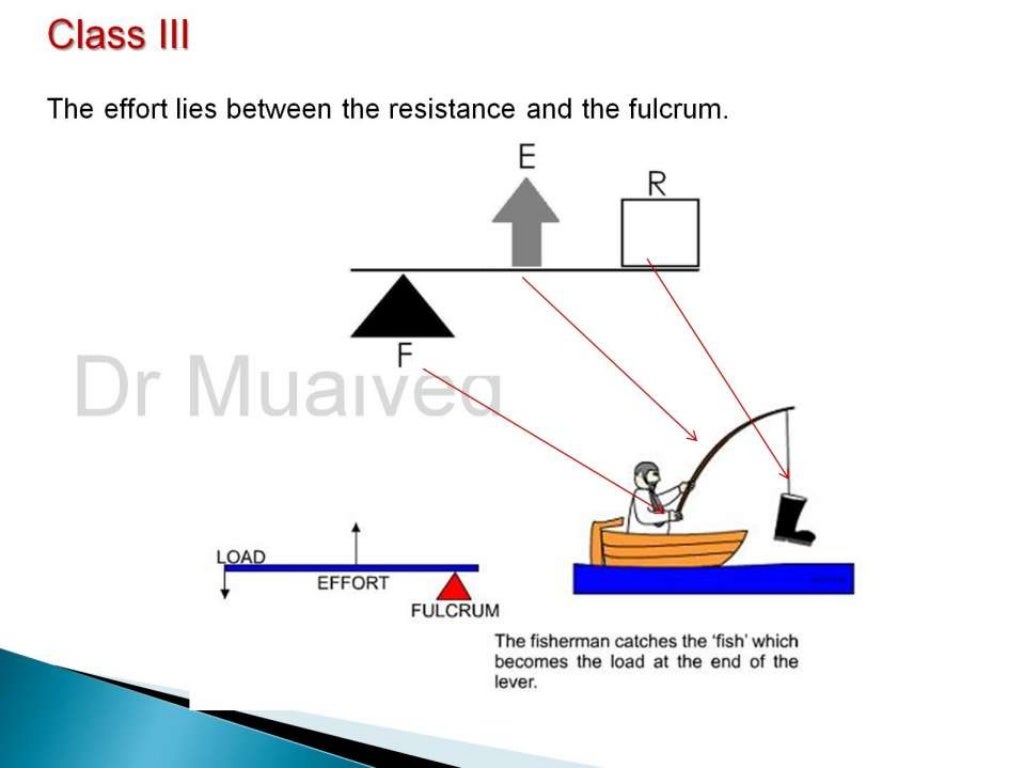 Rpd biomechanics principles of levers design consideration 4th year