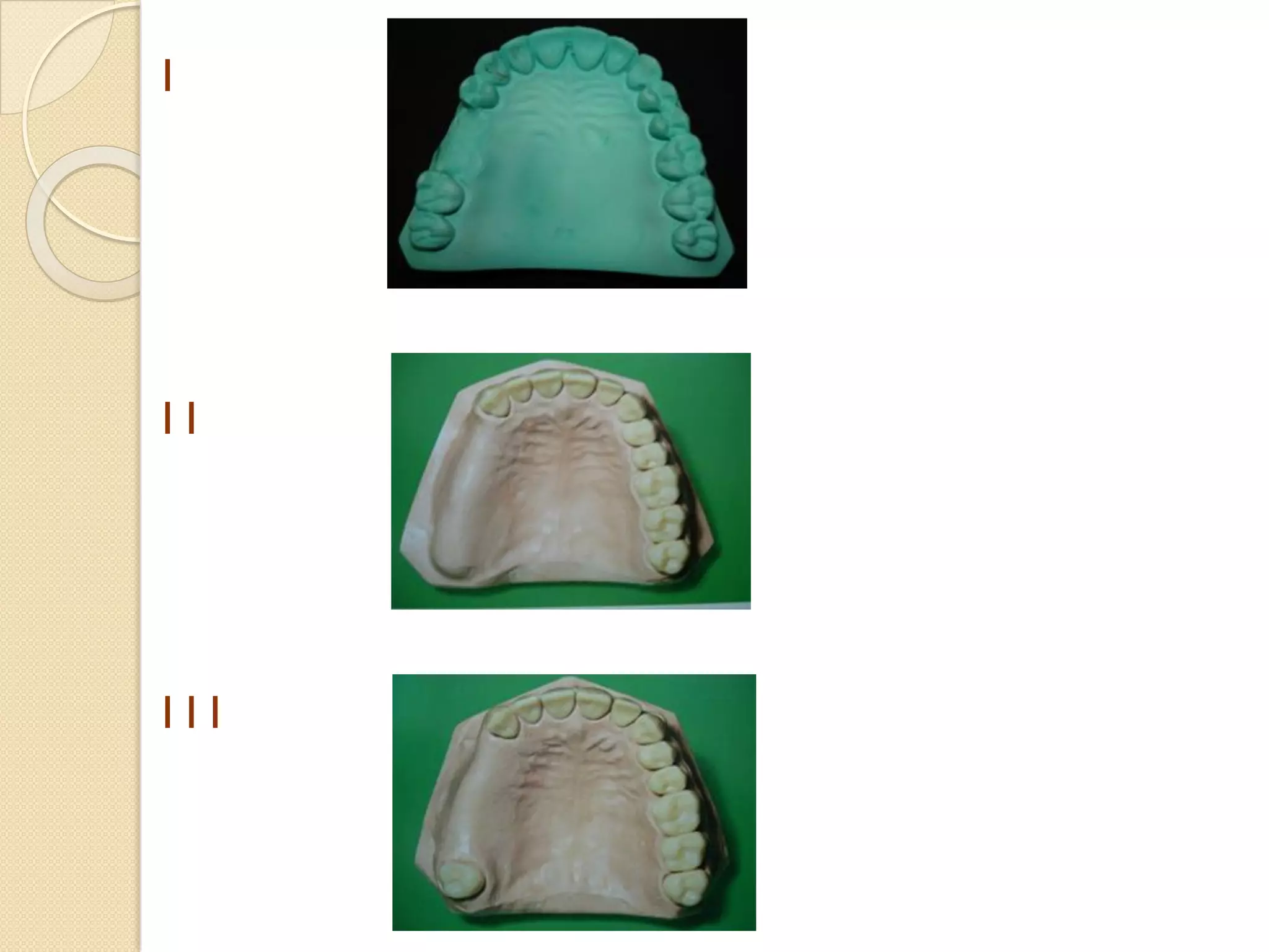 RPD Classification. | PDF