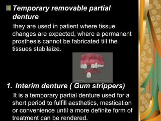 removable partial denture rpd classification.pdf