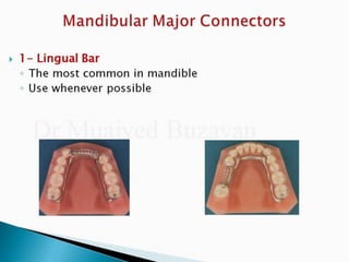 Rpd component + major connectors 2nd yr