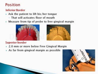 Rpd component + major connectors 2nd yr