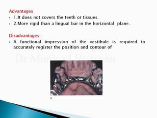 Rpd component + major connectors 2nd yr