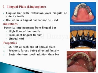 Rpd component + major connectors 2nd yr