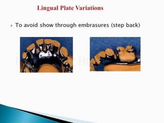 Rpd component + major connectors 2nd yr