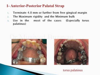 Rpd component + major connectors 2nd yr