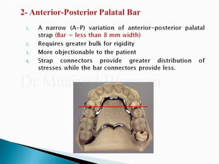 Rpd component + major connectors 2nd yr