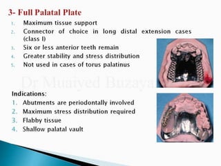Rpd component + major connectors 2nd yr
