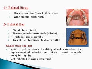 Rpd component + major connectors 2nd yr