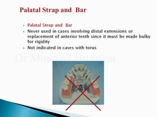Rpd component + major connectors 2nd yr