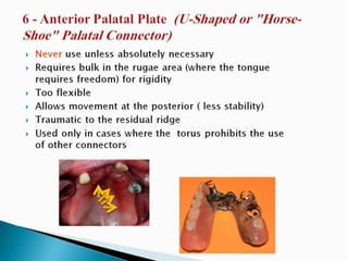 Rpd component + major connectors 2nd yr