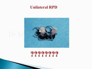 Rpd component + major connectors 2nd yr