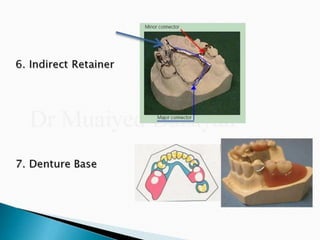 Rpd component + major connectors 2nd yr