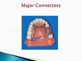 Rpd component + major connectors 2nd yr