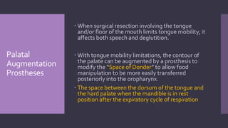Rpd consideration in maxillofacial prosthetics | PPTX