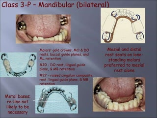 Mesial Rest Rpd RPD_design_considerations basicspart 2ppt.ppt