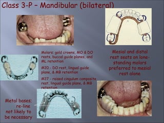 Class 3-P – Mandibular (bilateral)
Mesial and distal
rest seats on lone-
standing molars
preferred to mesial
rest alone
Molars: gold crowns, MO & DO
rests, buccal guide planes, and
ML retention
#20 - DO rest, lingual guide
plane, & MB retention
#27 - raised cingulum composite
rest, lingual guide plane, & MB
retention
Metal bases;
re-line
not likely to
be necessary
 