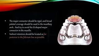removable partial denture RPD design part 2 | PPTX