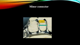 removable partial denture RPD design part 2 | PPTX