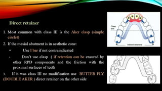 removable partial denture RPD design part 2 | PPTX