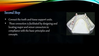 removable partial denture RPD design part 2 | PPTX