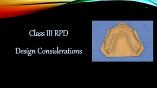 removable partial denture RPD design part 2 | PPTX
