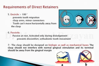 Rpd  direct retainers 2nd yr